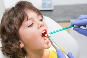a dentist is treating the tooth decay of the child