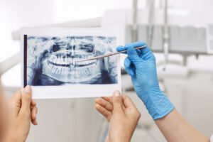 a dentist is examining the x-ray of the patient
