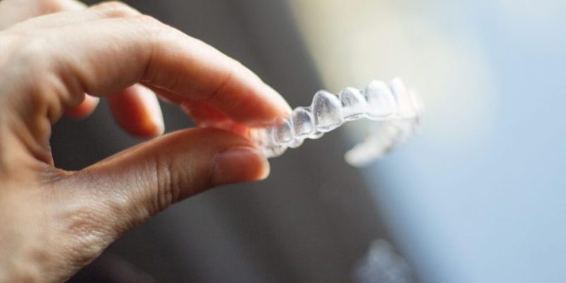 image2-2-768×512 clear aligners